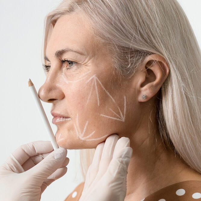 Procedure facial contouring