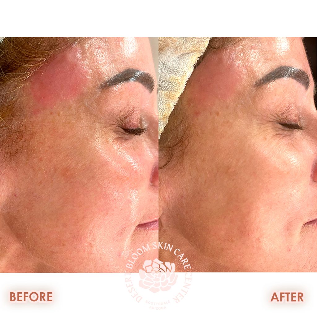 reduction in eczema and pigmentation, more even texture and an increase in hydration