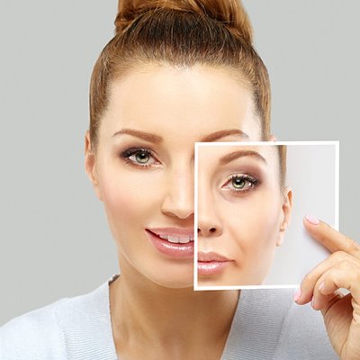 anti-aging-treatment anti-aging-treatment