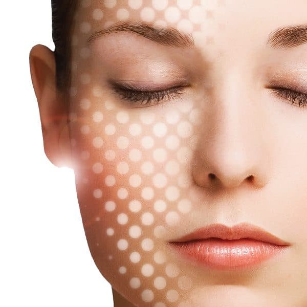 RF SKIN TIGHTENING
