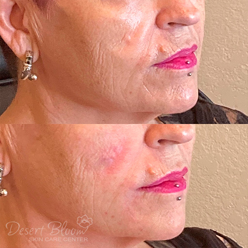 face threading