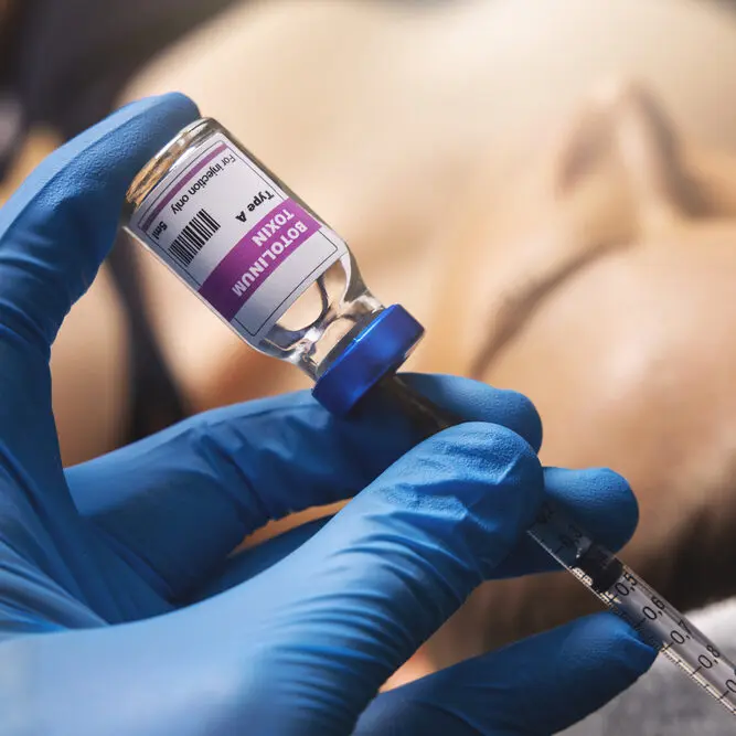 filling syringe with botulinum toxin