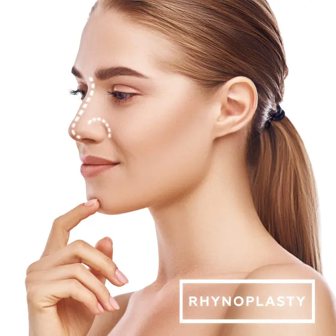 RHINOPLASTY