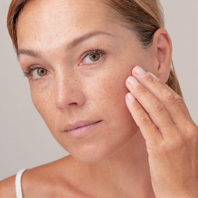 laser resurfacing treatment