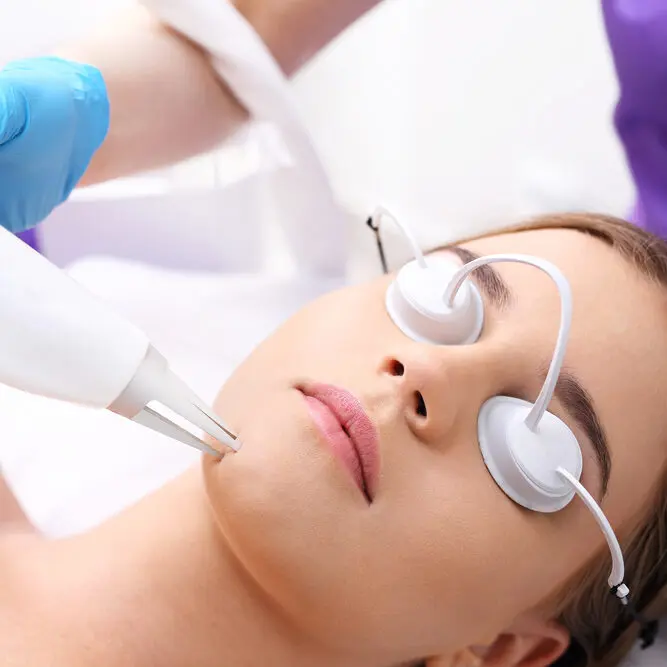 erbium laser resurfacing