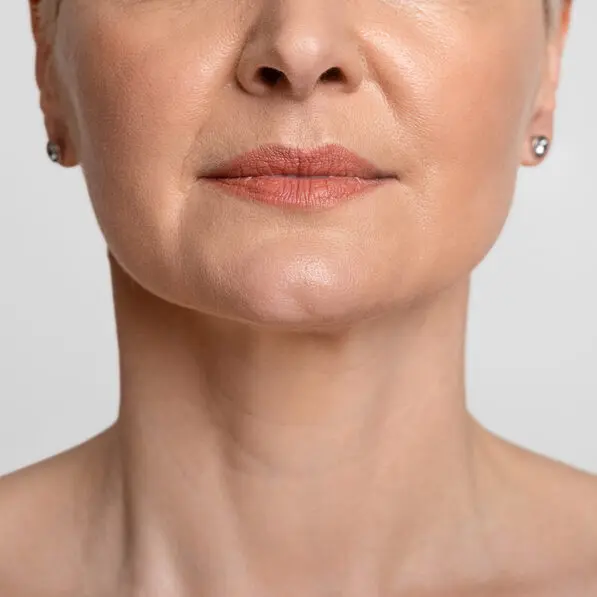 THE REHABILITATION PERIOD before Neck thread lift