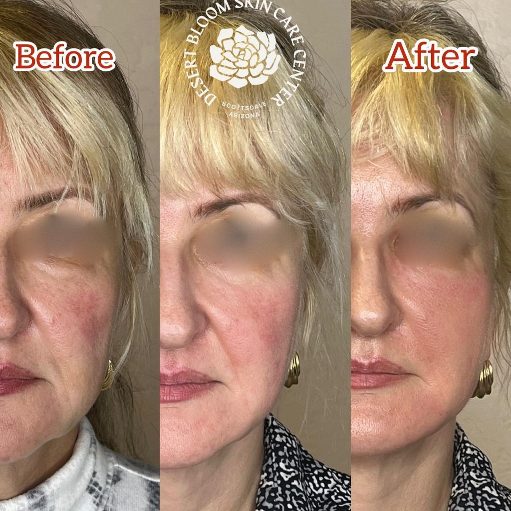 Before & after | Art of aging backwards