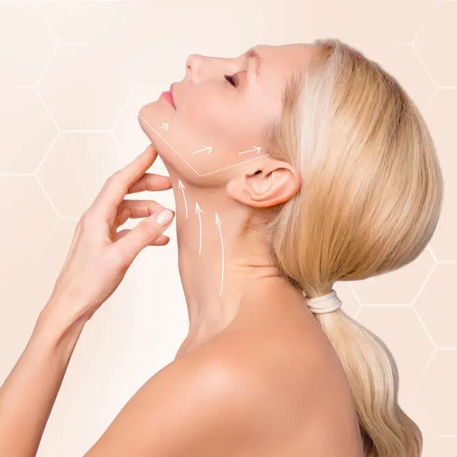 PDO neck lift