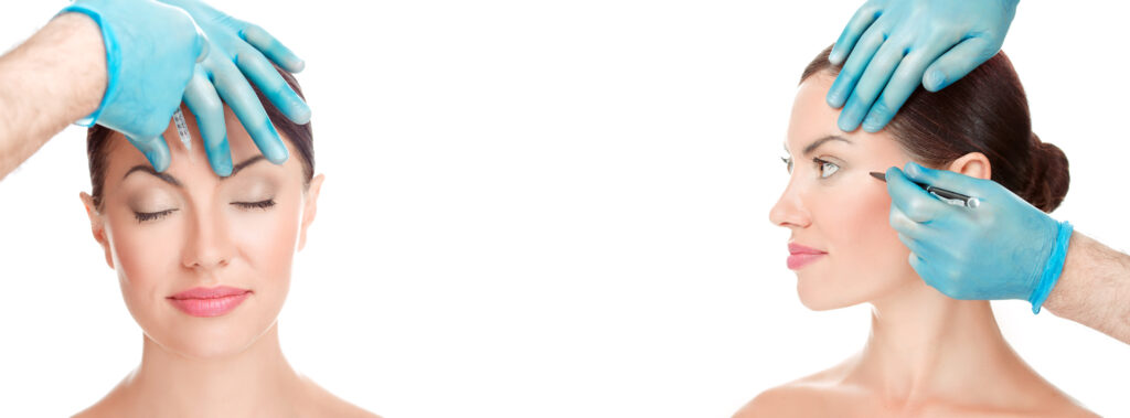 Areas for correction facial sculpting