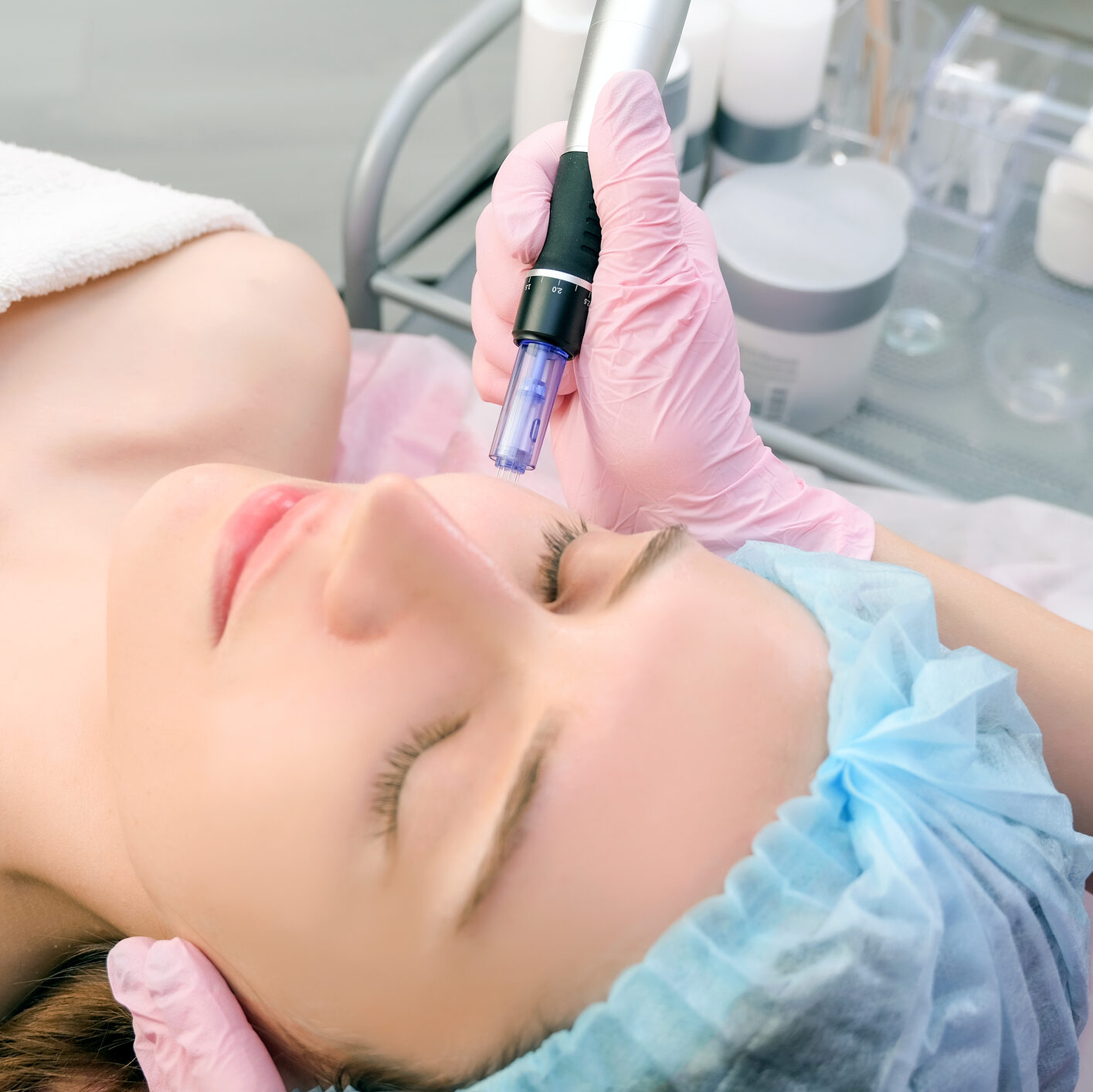 Microneedling