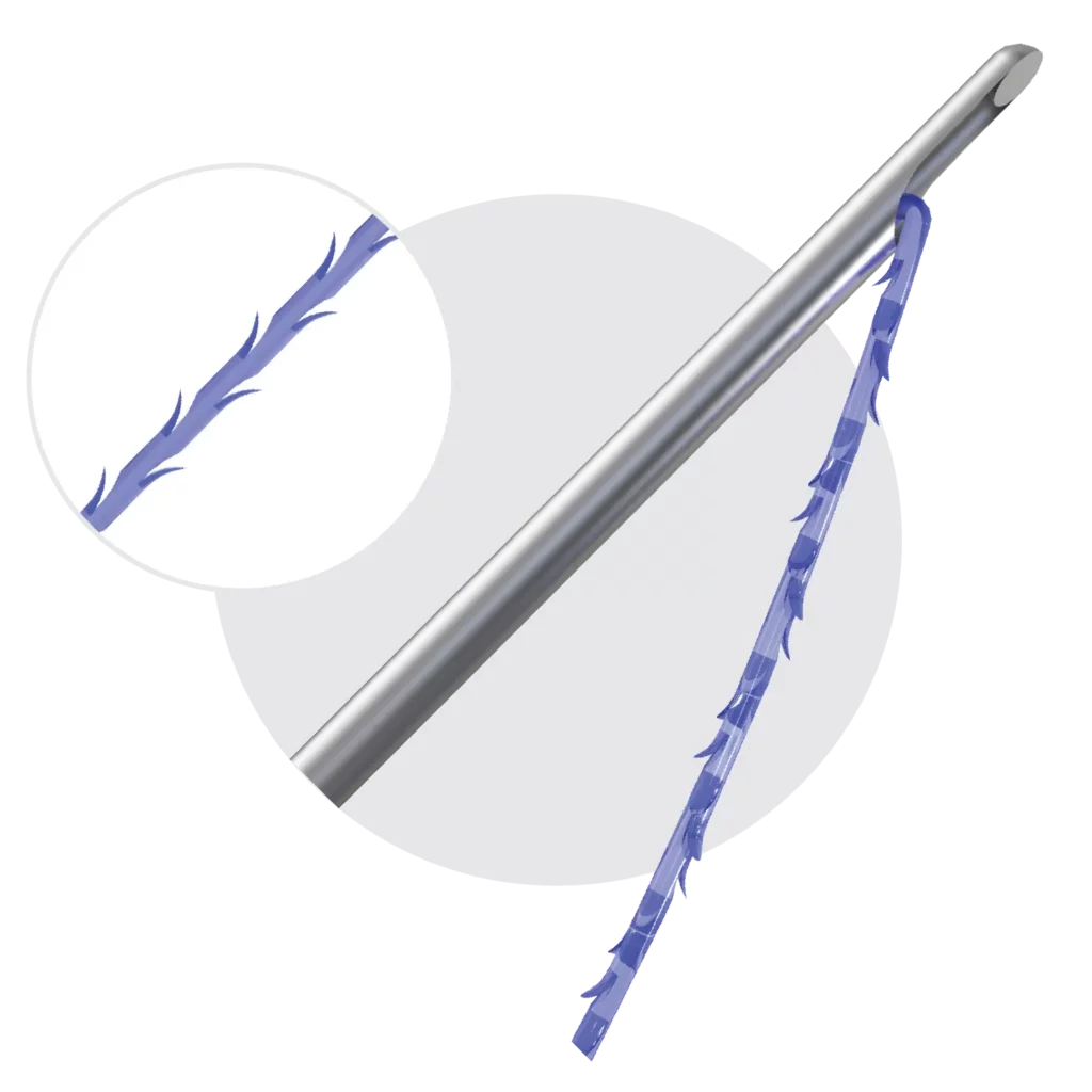 BARBED PDO THREADS