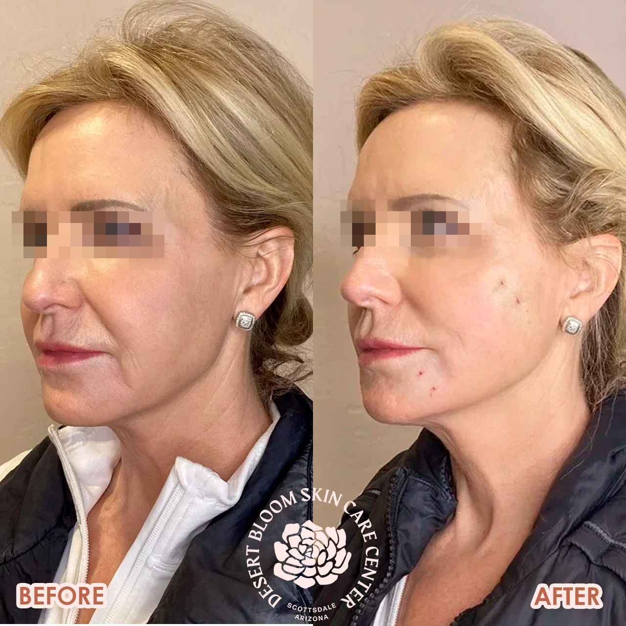 face-threading-before-after-photo-left