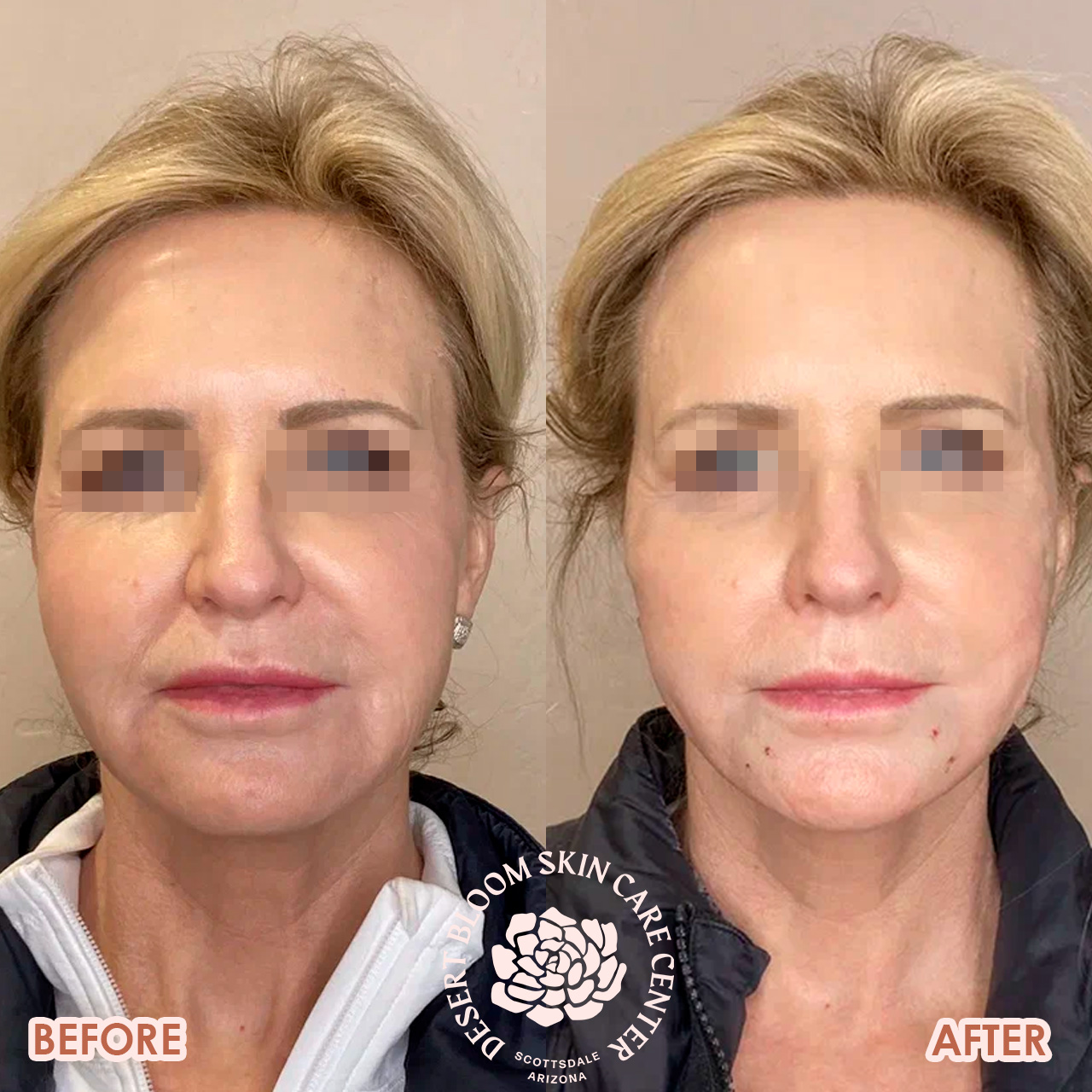 face-threading-before-after-photo