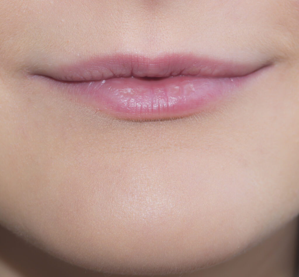 Plump Up Your Pout Expert Tips and Treatments for Thin Lips