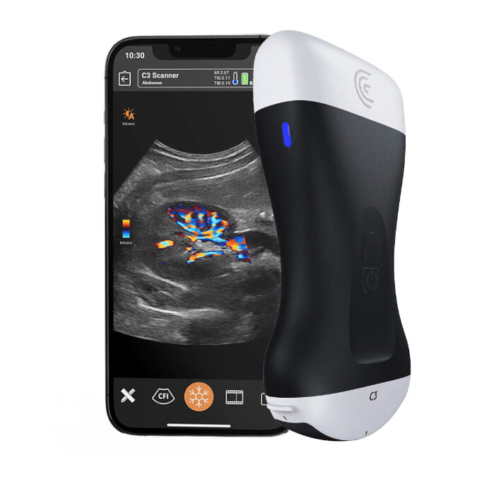 Ultrasound guided