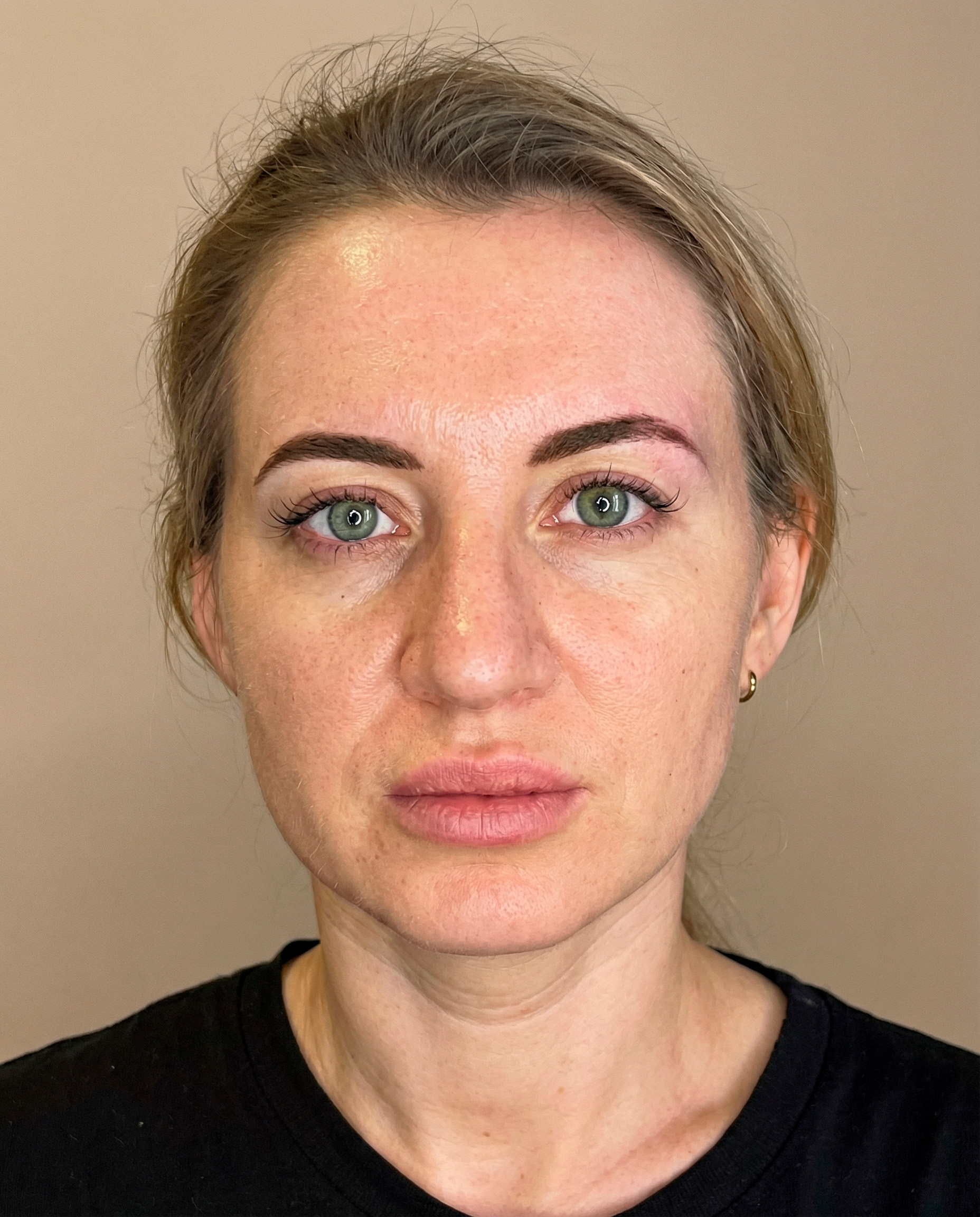 Facial Fatigue Recovery