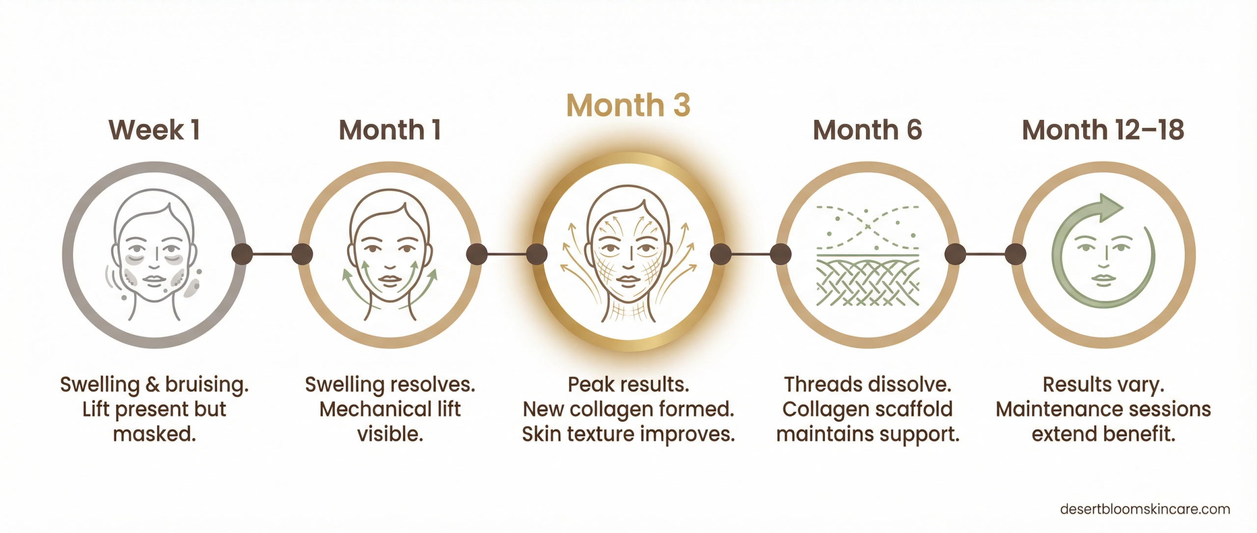 PDO thread lift results timeline — infographic showing expected outcomes from week 1 through month 18