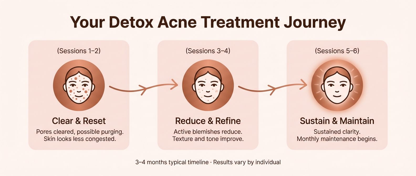 Detox acne treatment progress &mdash; sessions 1 through 6 skin improvement timeline