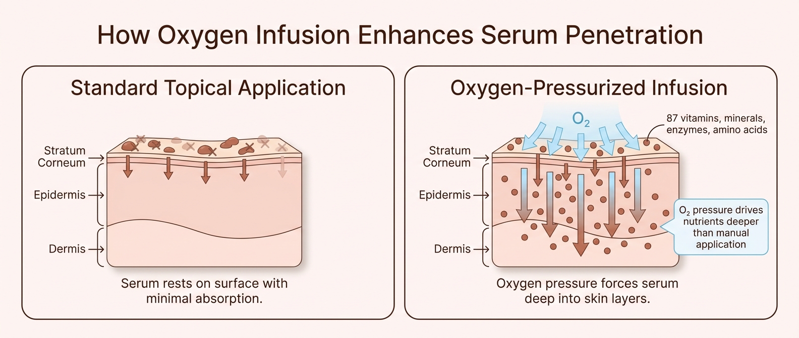 Oxygen facial serum penetration — pressurized O2 infusion vs standard topical application