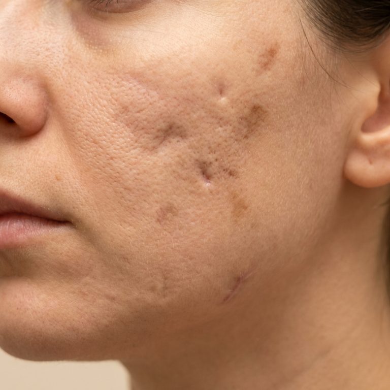 Scar — visible signs on patient's face