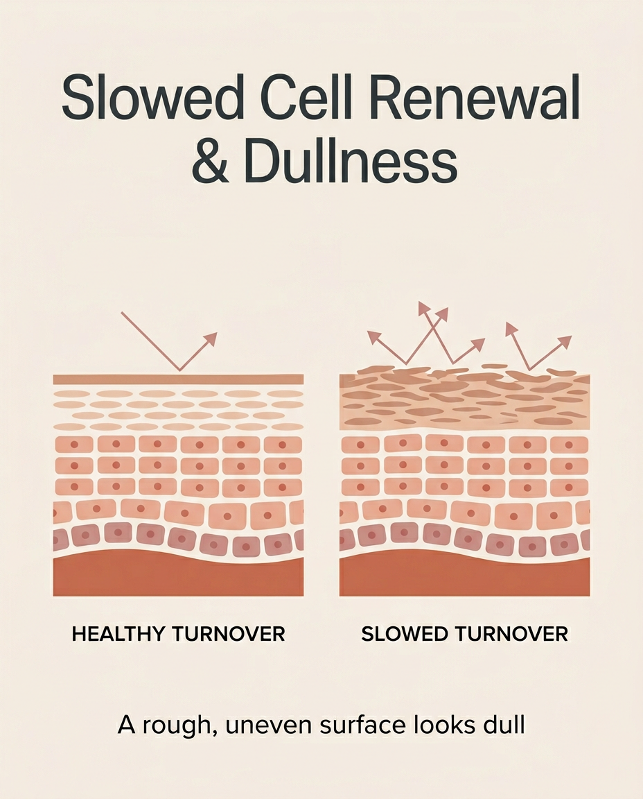 Infographic: slowed skin-cell turnover leaves a rough, uneven, dull surface